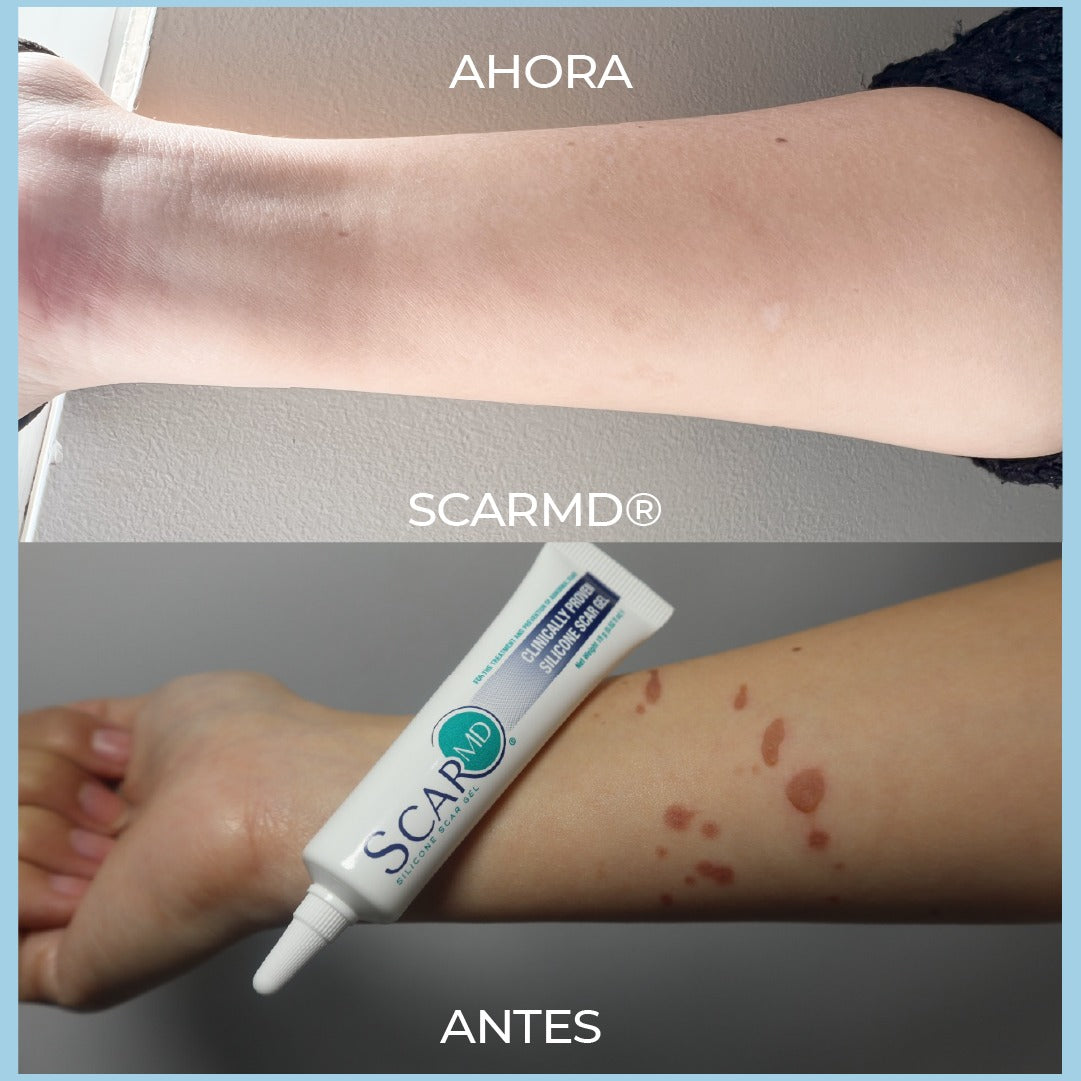 ScarMD - Gel para eliminación de cicatrices