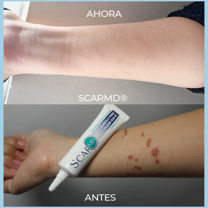 ScarMD - Gel para eliminación de cicatrices